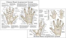 Chinese Hand Acupuncture Chart